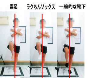 有痛性外脛骨と靴下|片足立ちで確認する方法 素足と靴下を履いた状態で片足立ちを行い、身体の傾きと足首の位置を比較した画像