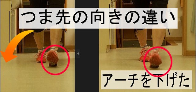シューズ内側の当たり方を変えた前後で、片足支持時の身体の傾きとつま先の向きを比較した画像