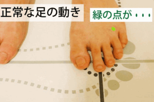 足のアーチが崩れる原因は何ですか? 第4中足骨の動き