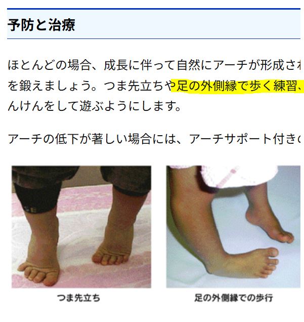 扁平足の運動として足の外側縁を使って歩く方法を示した画像
