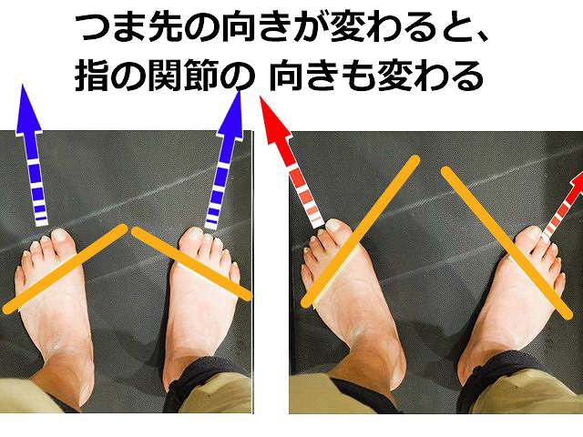 つま先の向きによって足指の付け根にあるMP関節が向く方向も変わることを示した画像