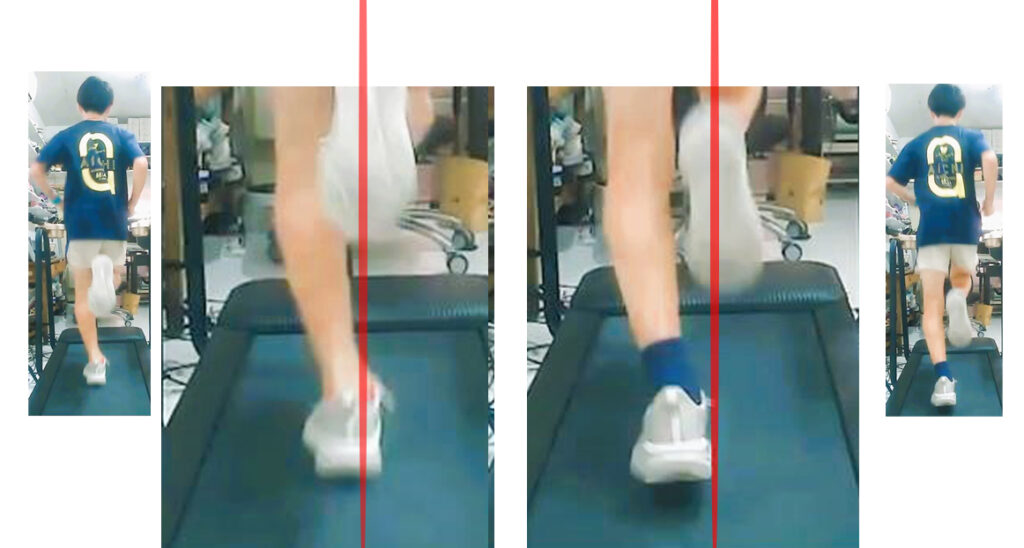 一本線上を踏む一軸走行によって足首の外反角度が大きくなる様子を示した画像