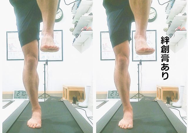 小指が使えている状態で片足立ちを行い、身体の傾きを確認している画像